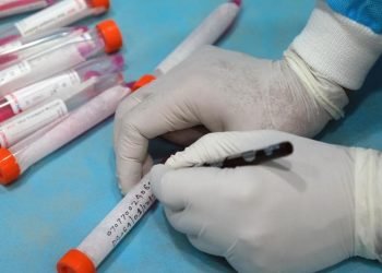 ആര്‍.ടി.പി.സി.ആറിന് 500 രൂപ: സര്‍ക്കാര്‍ തീരുമാനം റദ്ദാക്കി കോടതി