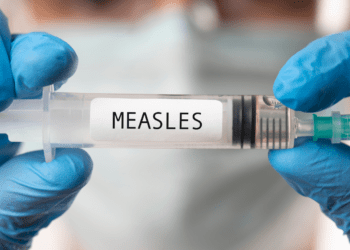 യാത്രക്കാരന് മീസെൽസ് സ്ഥിരീകരിച്ചതിനെ തുടർന്ന് ജാഗ്രതാ നിർദ്ദേശം പ്രഖ്യാപിച്ച് അധികൃതർ